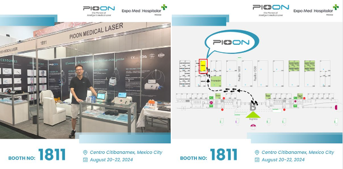 Join Us Today at Expo Med | Hospitalar Mexico 2024 – Unveil the Future of Laser Technology!